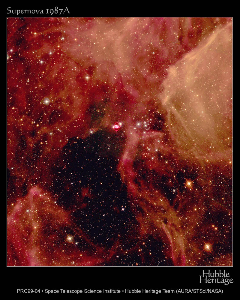 SN1987A